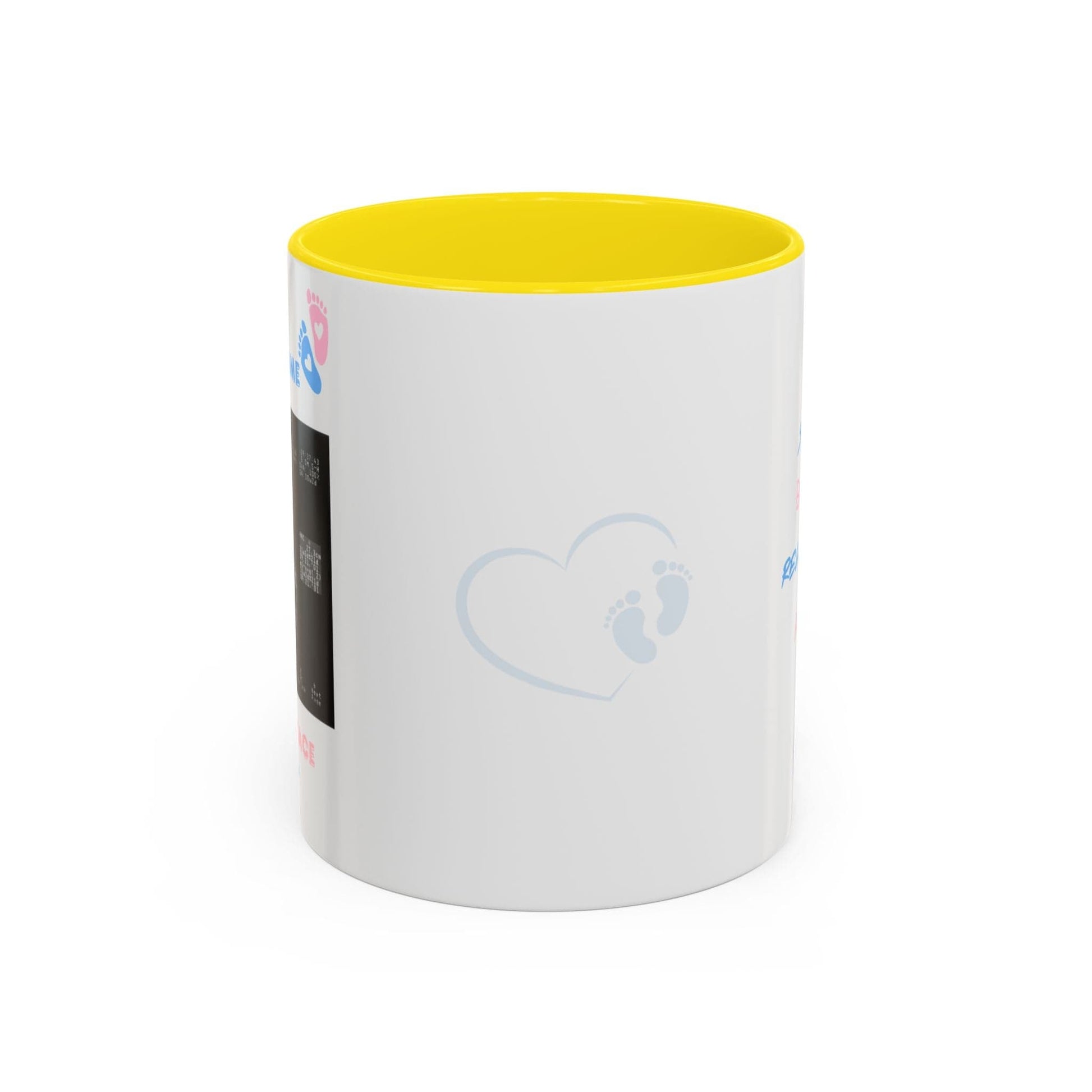 Printify Mug 11oz / Yellow Parent Coffee Mug, Custom Baby Announcement Gift, Starring Baby, Due Date Mug, Pregnancy Announcement Cup