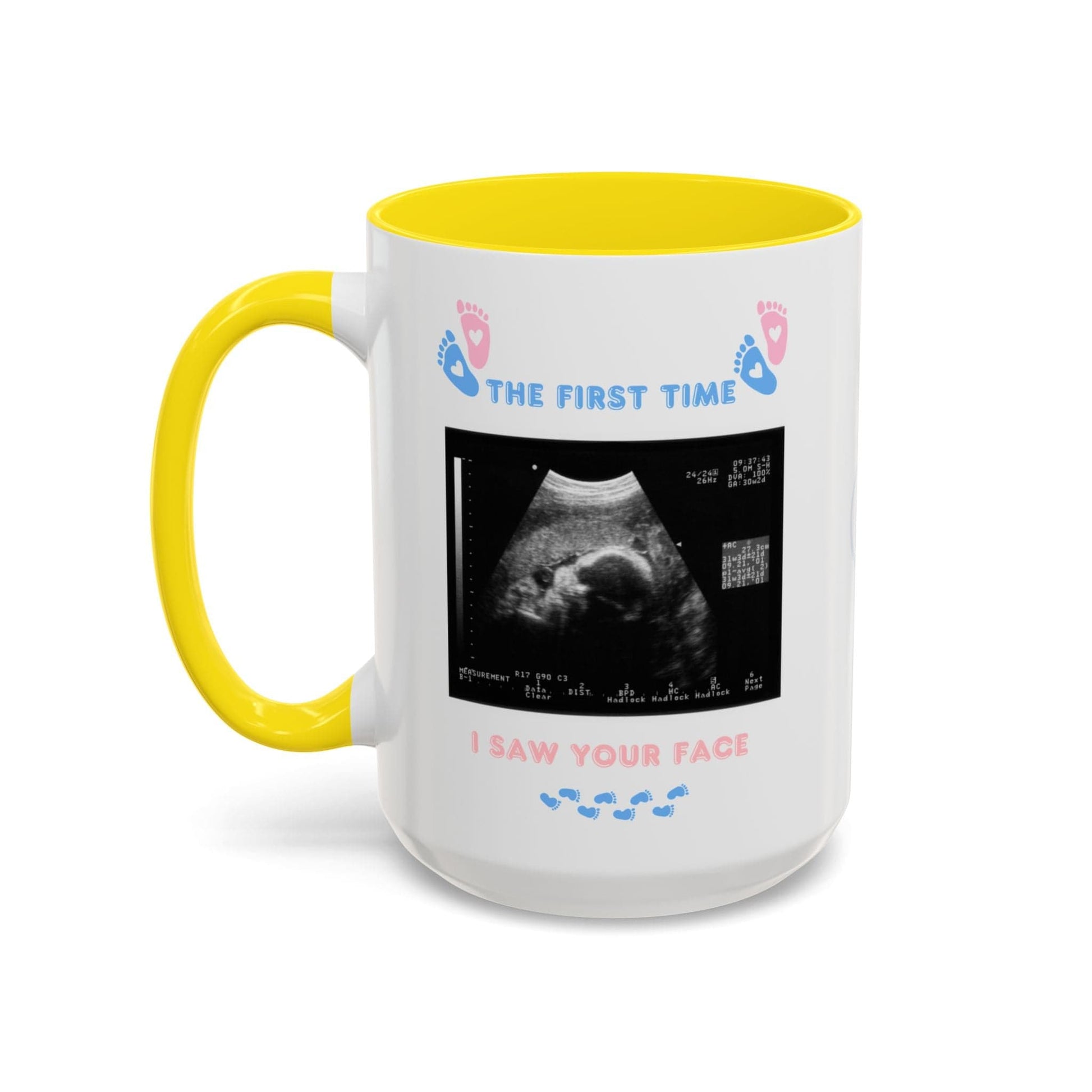 Printify Mug 15oz / Yellow Parent Coffee Mug, Custom Baby Announcement Gift, Starring Baby, Due Date Mug, Pregnancy Announcement Cup