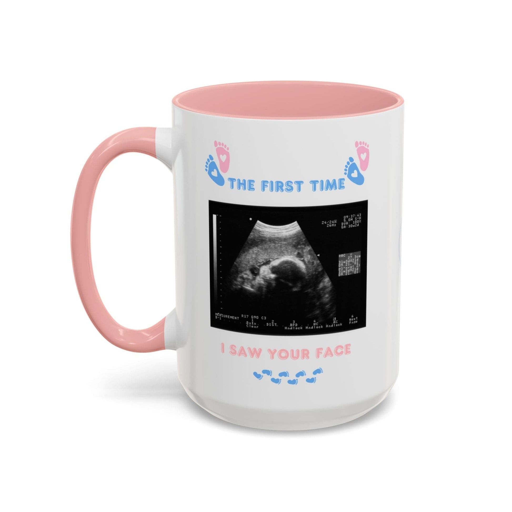 Printify Mug Parent Coffee Mug, Custom Baby Announcement Gift, Starring Baby, Due Date Mug, Pregnancy Announcement Cup