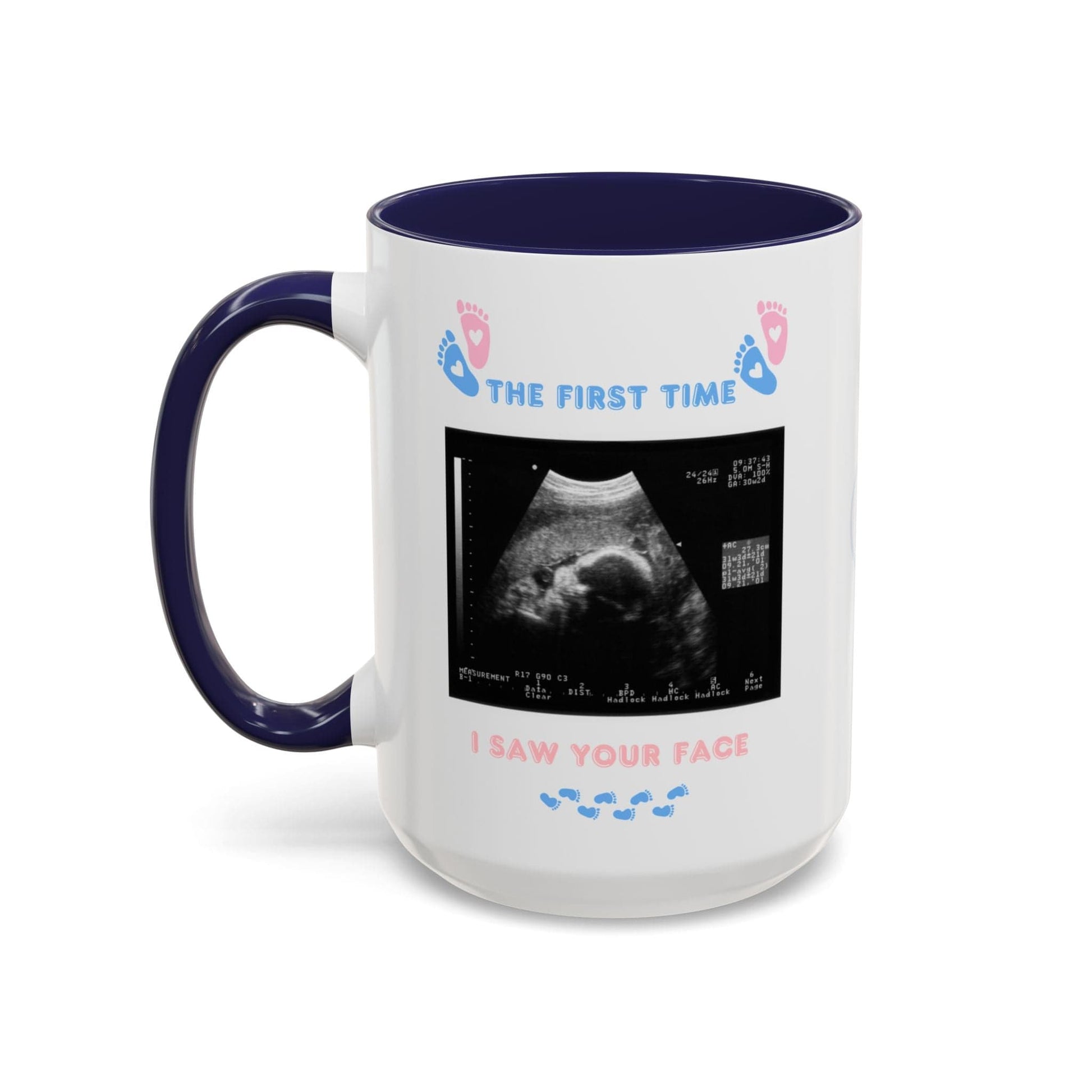 Printify Mug Parent Coffee Mug, Custom Baby Announcement Gift, Starring Baby, Due Date Mug, Pregnancy Announcement Cup