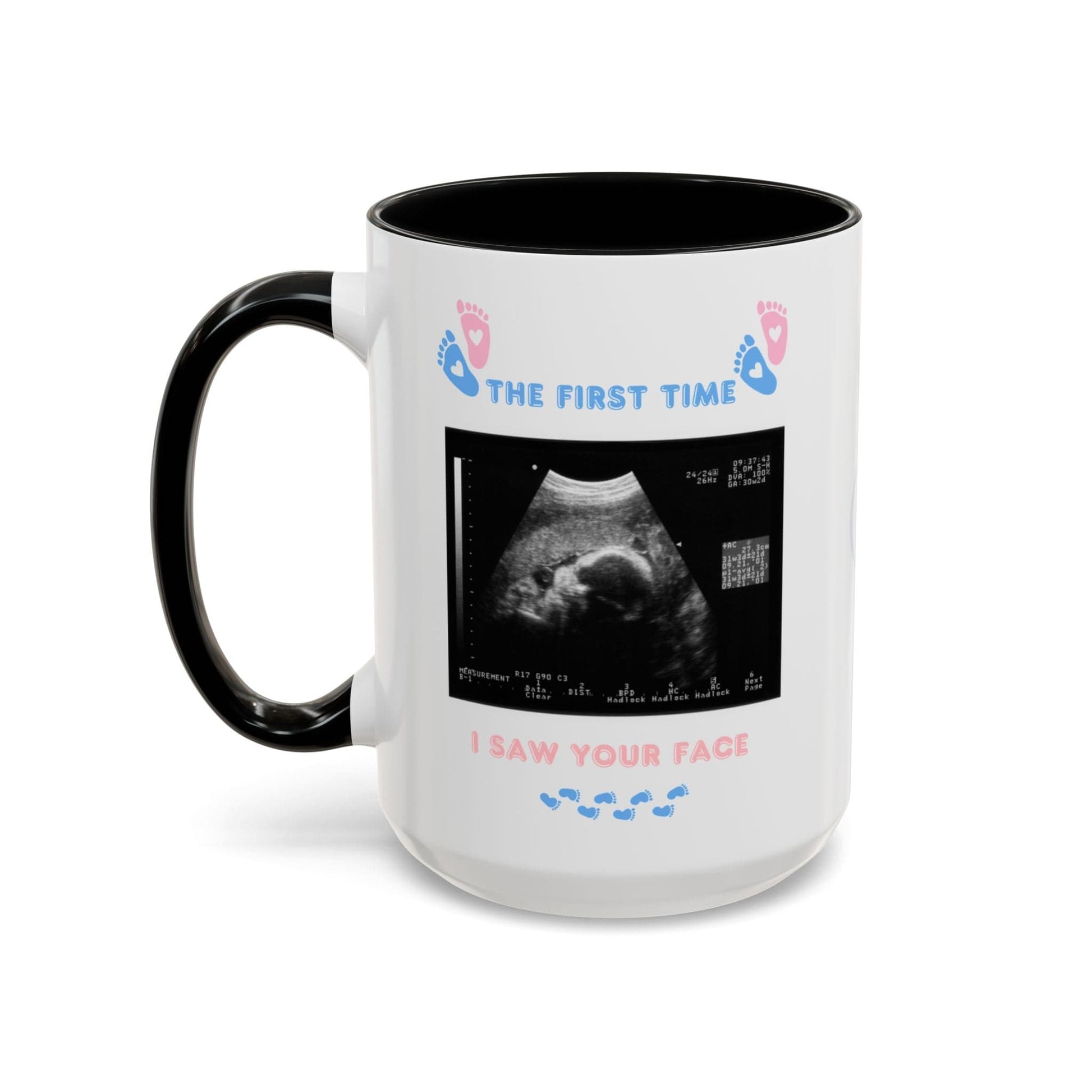 Printify Mug Parent Coffee Mug, Custom Baby Announcement Gift, Starring Baby, Due Date Mug, Pregnancy Announcement Cup