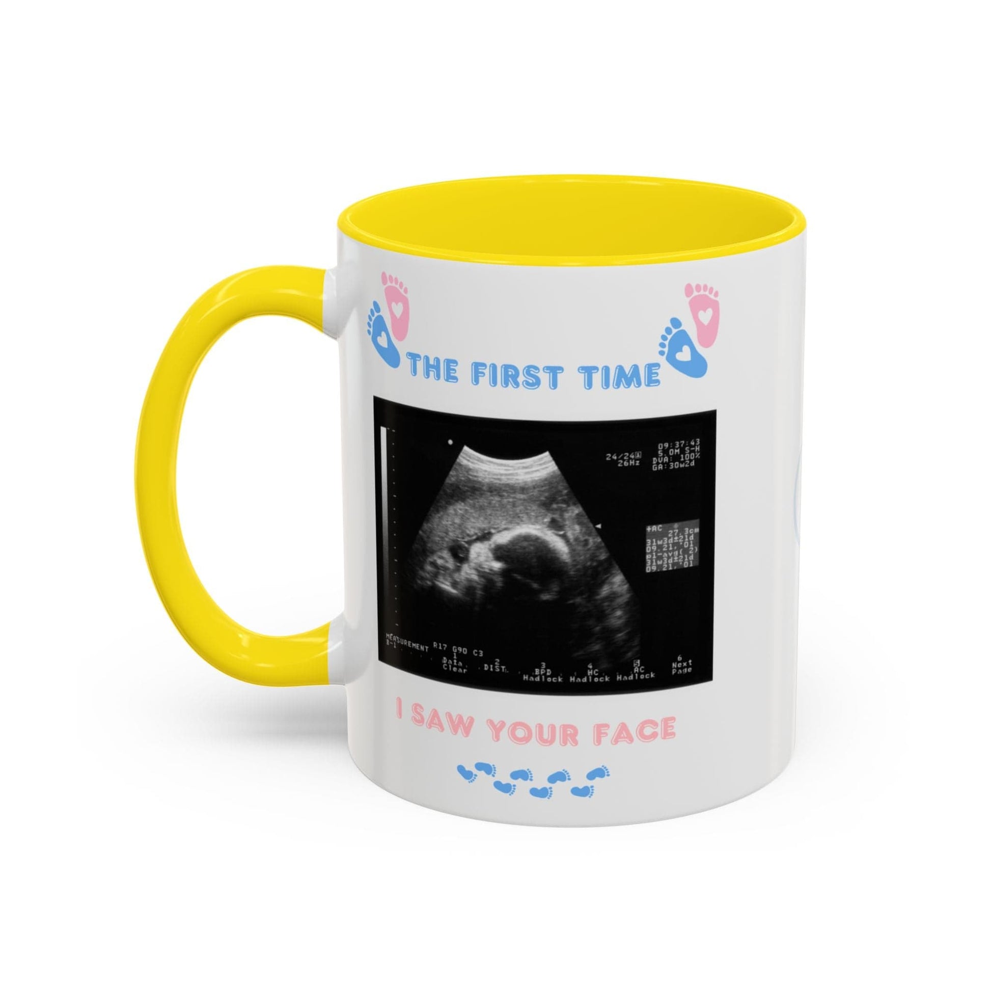 Printify Mug Parent Coffee Mug, Custom Baby Announcement Gift, Starring Baby, Due Date Mug, Pregnancy Announcement Cup