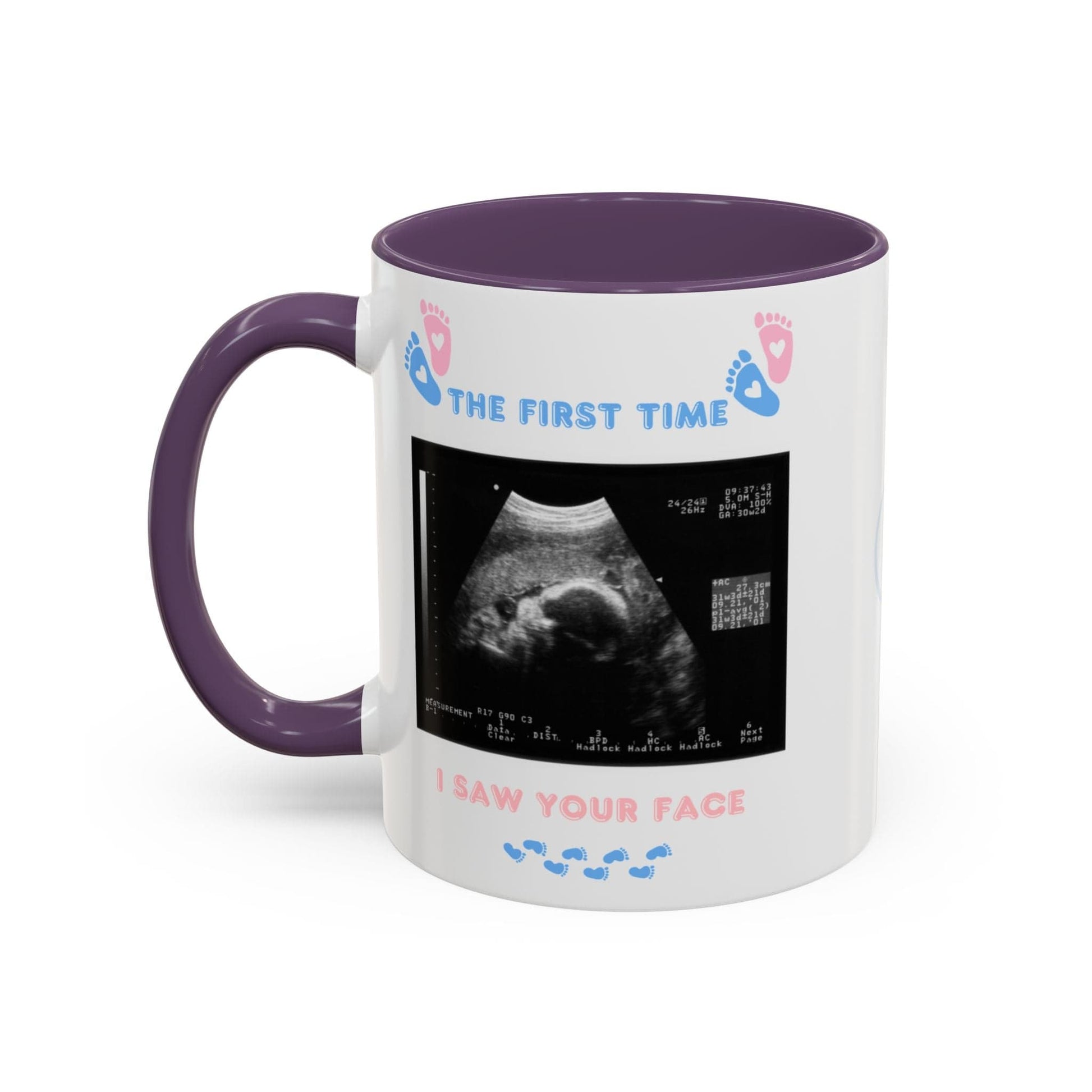 Printify Mug Parent Coffee Mug, Custom Baby Announcement Gift, Starring Baby, Due Date Mug, Pregnancy Announcement Cup