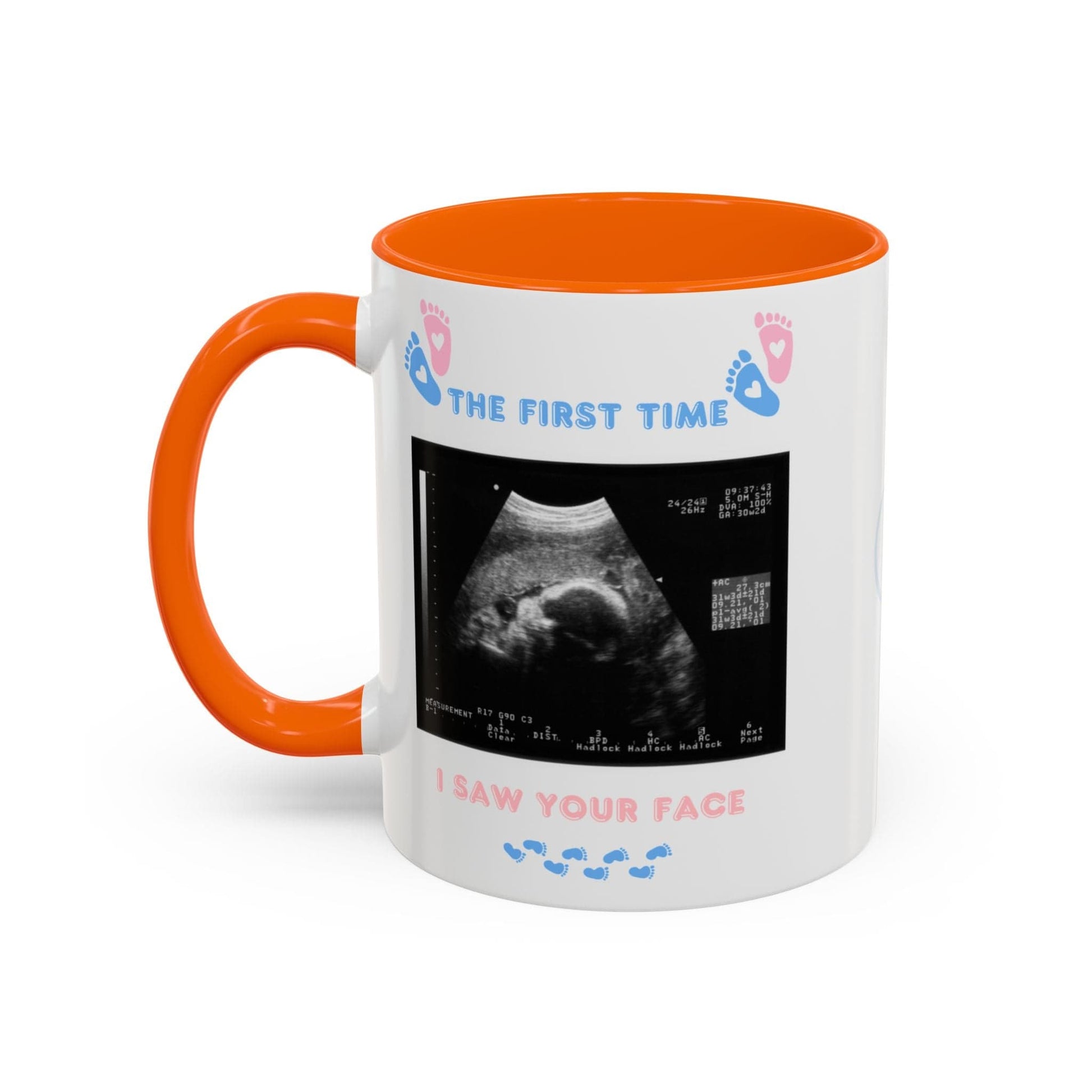 Printify Mug Parent Coffee Mug, Custom Baby Announcement Gift, Starring Baby, Due Date Mug, Pregnancy Announcement Cup