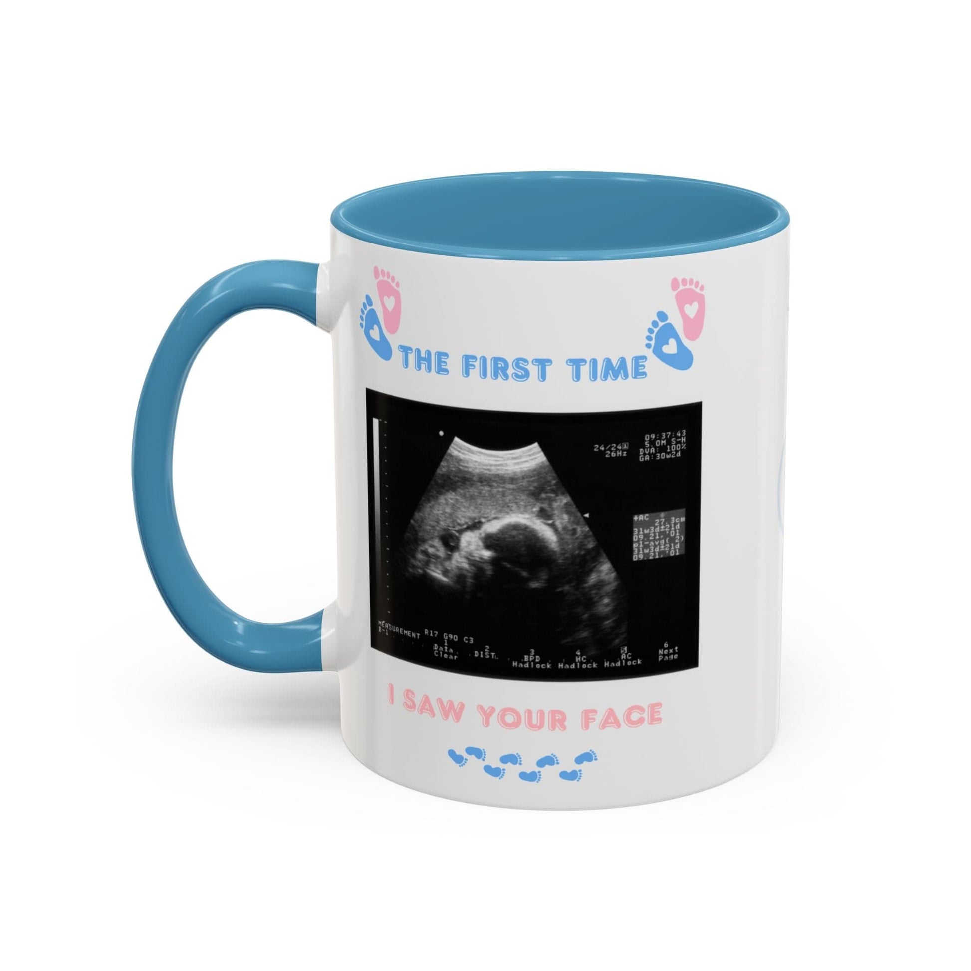 Printify Mug Parent Coffee Mug, Custom Baby Announcement Gift, Starring Baby, Due Date Mug, Pregnancy Announcement Cup