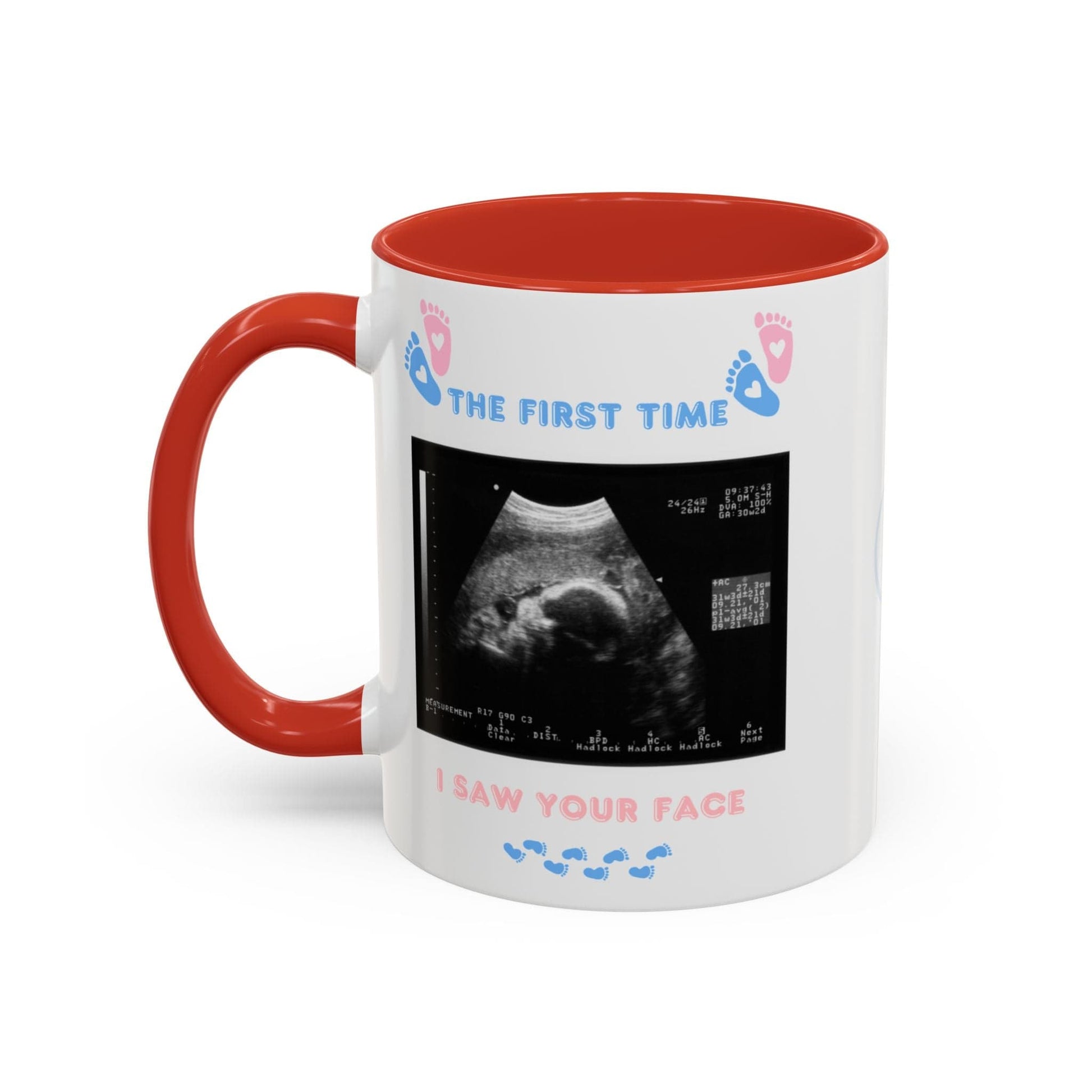 Printify Mug Parent Coffee Mug, Custom Baby Announcement Gift, Starring Baby, Due Date Mug, Pregnancy Announcement Cup