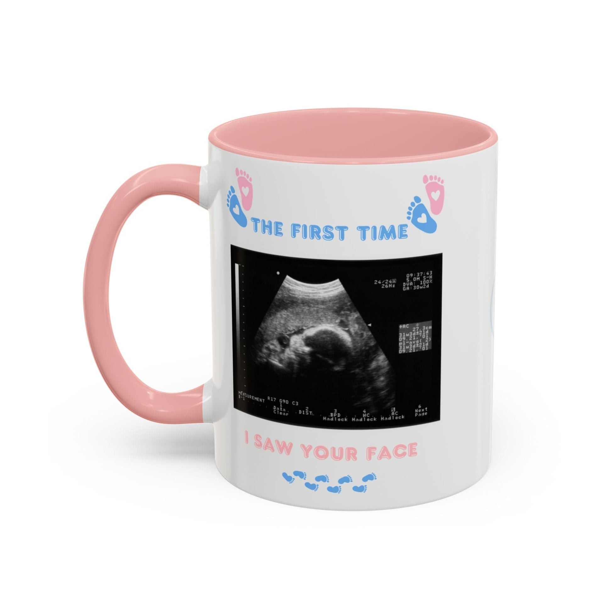 Printify Mug Parent Coffee Mug, Custom Baby Announcement Gift, Starring Baby, Due Date Mug, Pregnancy Announcement Cup