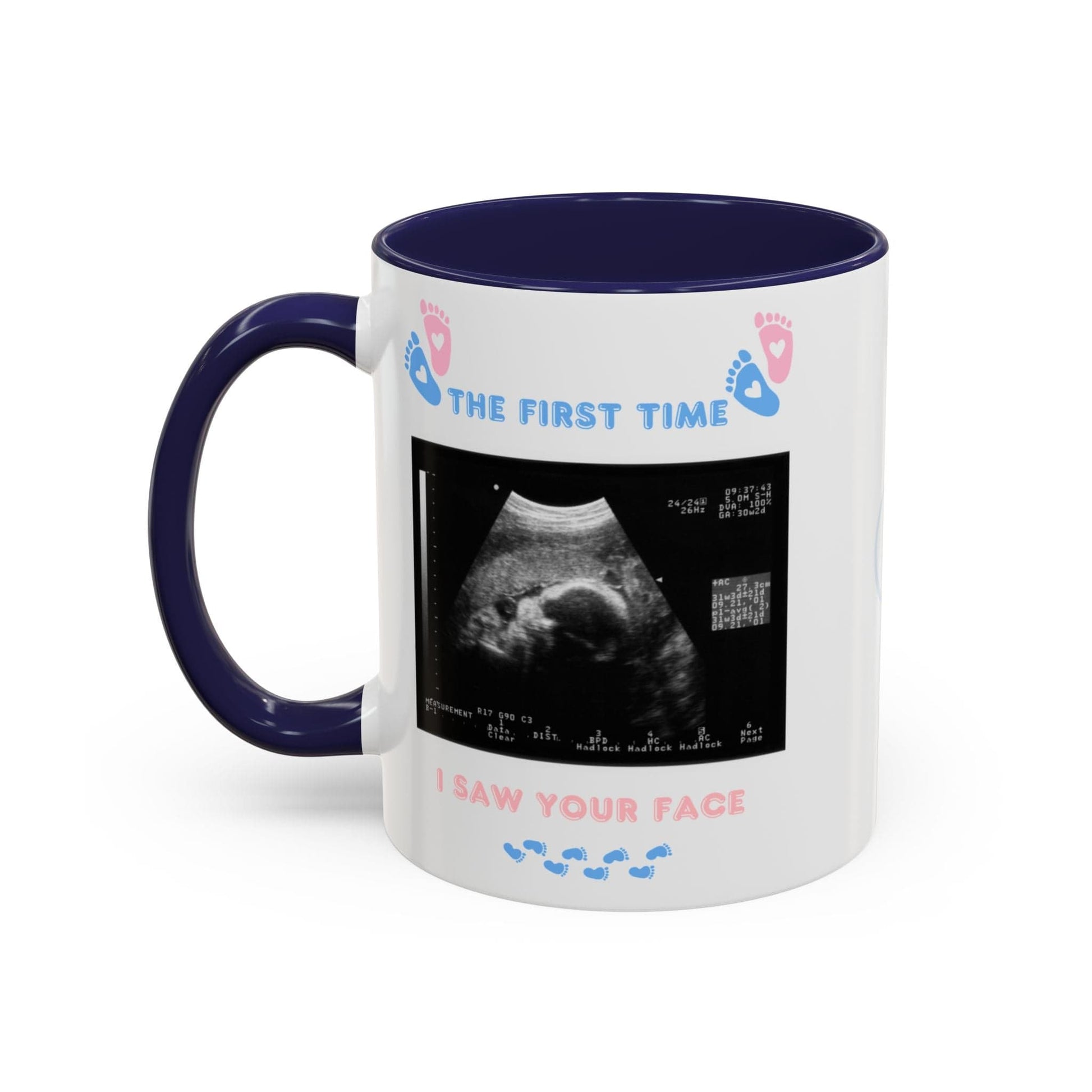 Printify Mug Parent Coffee Mug, Custom Baby Announcement Gift, Starring Baby, Due Date Mug, Pregnancy Announcement Cup