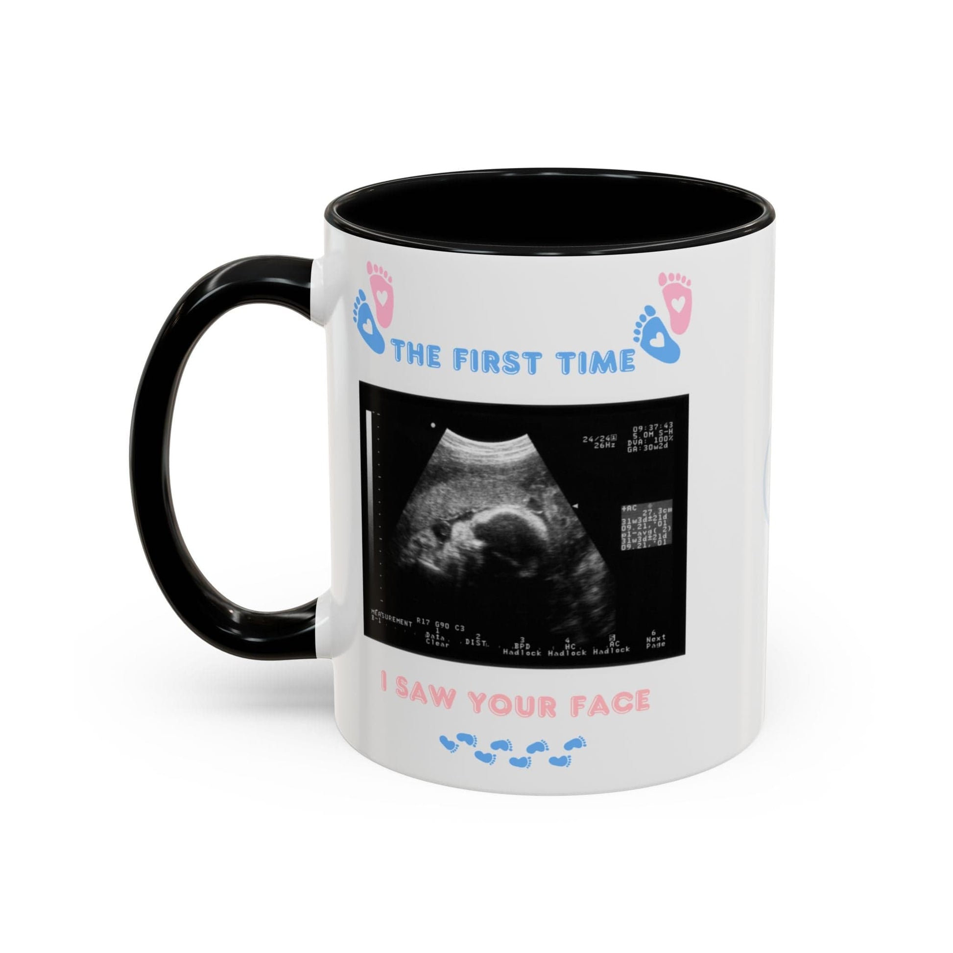 Printify Mug Parent Coffee Mug, Custom Baby Announcement Gift, Starring Baby, Due Date Mug, Pregnancy Announcement Cup